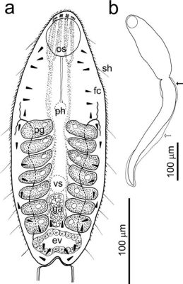  Heterophyes Heterophyes: Parasitär lebender Dickdarmbewohner mit Vorliebe für Fisch!